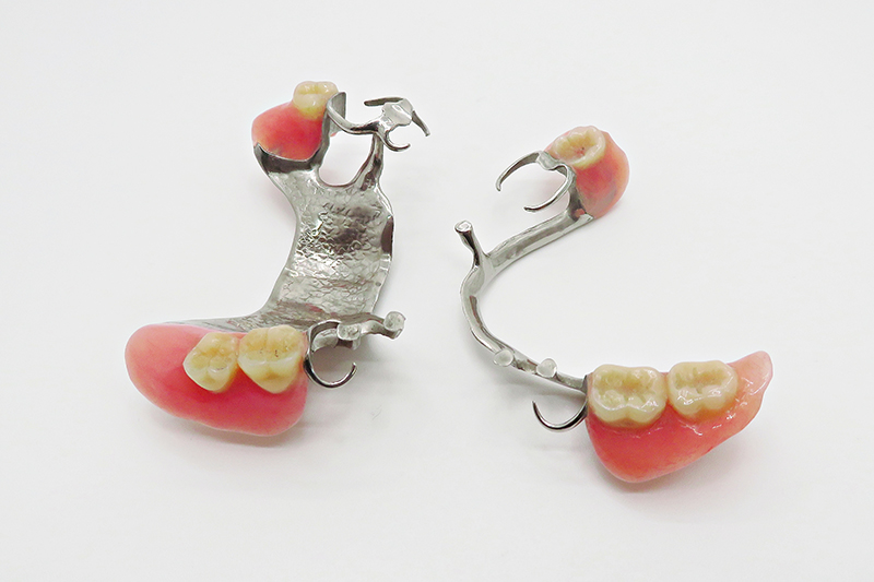 入れ歯、義歯とは